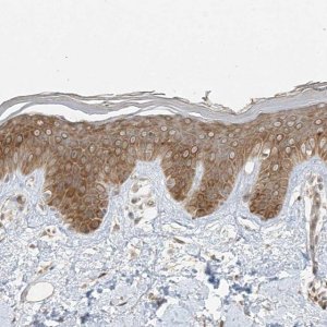 Anti-IL36RN antibody produced in rabbit 