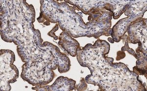 Anti-Integrin -5 Antibody, clone 5E18 ZooMAb� Rabbit Monoclonal 
