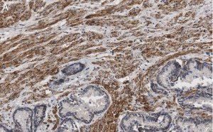 Anti-Integrin beta 1 Antibody, clone HUTS-4 ZooMAb� Mouse Monoclonal 
