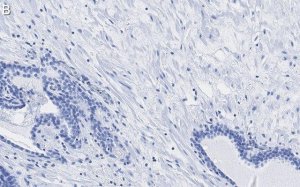 Anti-Integrin beta 1 Antibody, clone HUTS-4 ZooMAb� Mouse Monoclonal 
