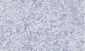 Anti-Integrin pan-V Antibody, clone EM01309 , ZooMAb� Rabbit Monoclonal 
