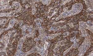 Anti-Integrin pan-V Antibody, clone EM01309 , ZooMAb� Rabbit Monoclonal 