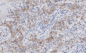 Anti-Integrin V3 Antibody, clone EM22703 ZooMAb� Rabbit Monoclonal 