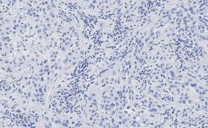 Anti-Integrin V3 Antibody, clone EM22703 ZooMAb� Rabbit Monoclonal 