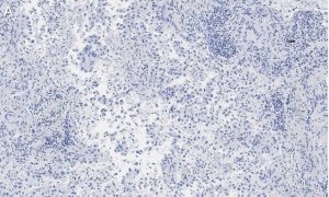 Anti-Integrin V5 Antibody, clone EM09902 , ZooMAb� Rabbit Monoclonal 