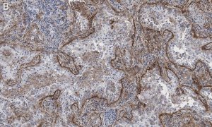 Anti-Integrin V5 Antibody, clone EM09902 , ZooMAb� Rabbit Monoclonal 