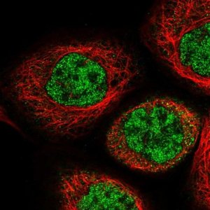 Anti-IPMK antibody produced in rabbit 