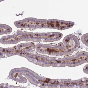 Anti-ITGAE antibody produced in rabbit 