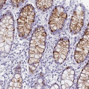 Anti-ITLN1 antibody produced in rabbit HPA063275-100UL