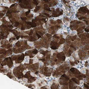 Anti-JTB antibody produced in rabbit 