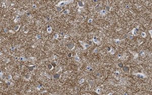 Anti-K+/Cl- Cotransporter-2 Antibody, clone 5E13 ZooMAb� Rabbit Monoclonal 