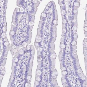 Anti-KCNC1 antibody produced in rabbit 