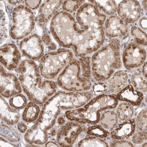 Anti-KCNIP1 antibody produced in rabbit HPA022864-100UL