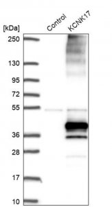 Anti-KCNK17 antibody produced in rabbit HPA043892-100UL