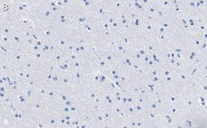 Anti-KCNQ2 Antibody, clone 2G18 ZooMAb� Rabbit Monoclonal 
