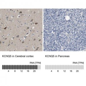 Anti-KCNQ5 antibody produced in rabbit 