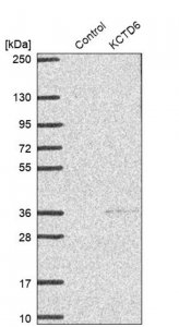 Anti-KCTD6 antibody produced in rabbit 