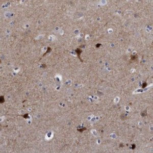 Anti-KCTD8 antibody produced in rabbit 