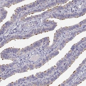 Anti-KIF19 antibody produced in rabbit 