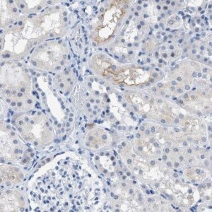 Anti-KIFC3 antibody produced in rabbit 