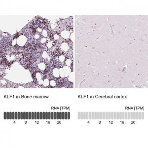 Anti-KLF1 antibody produced in rabbit 