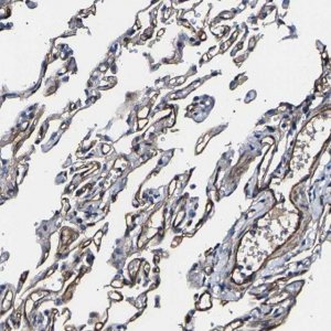 Anti-KLHL42 antibody produced in rabbit 