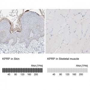 Anti-KPRP antibody produced in rabbit 