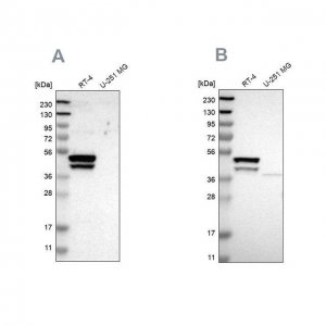 Anti-KRT23 antibody produced in rabbit 