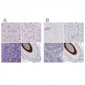 Anti-KRT25 antibody produced in rabbit 