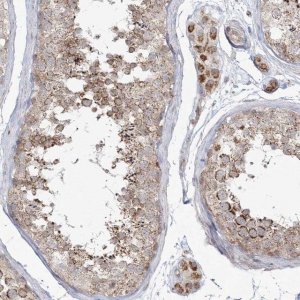 Anti-LACTB antibody produced in rabbit 