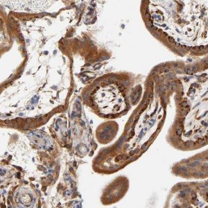 Anti-LAMB1 antibody produced in rabbit HPA004132-100UL