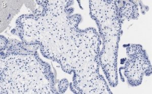 Anti-LAMP-1 Antibody, clone 2E9 ZooMAb� Rabbit Monoclonal 