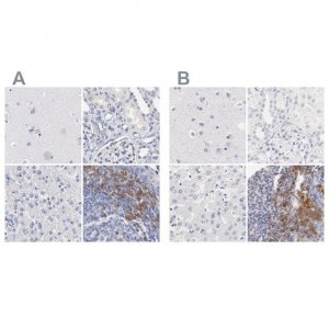 Anti-LAX1 antibody produced in rabbit HPA002461-100UL