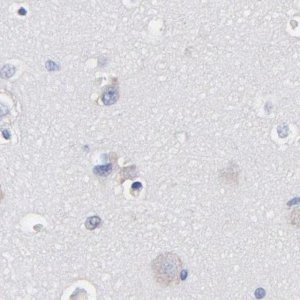 Anti-LAX1 antibody produced in rabbit HPA002461-100UL