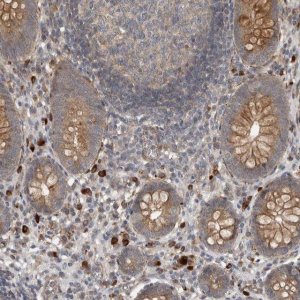 Anti-LBHD1 antibody produced in rabbit 