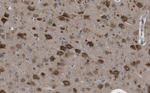 Anti-LC3B Antibody, clone 12K5, ZooMAb� Rabbit Monoclonal 
