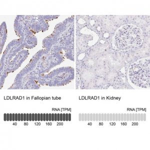 Anti-LDLRAD1 antibody produced in rabbit 
