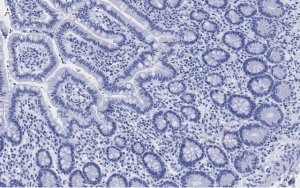 Anti-LONP1 Antibody, clone 1I18, ZooMAb� Rabbit Monoclonal 