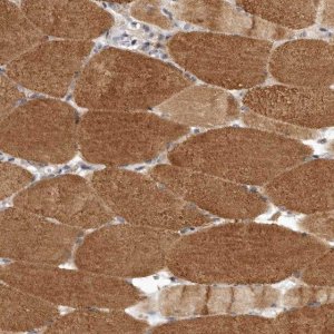 Anti-LRP5L antibody produced in rabbit 