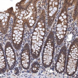 Anti-LRRC2 antibody produced in rabbit HPA039138-100UL