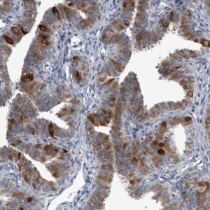 Anti-LRRC6 antibody produced in rabbit 