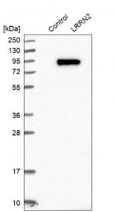 Anti-LRRN2 antibody produced in rabbit 