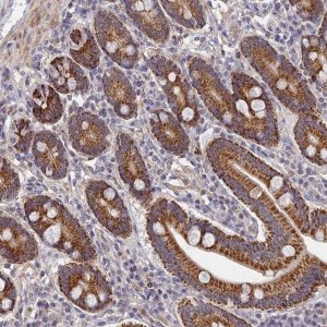 Anti-LSM5 antibody produced in rabbit HPA019054-100UL