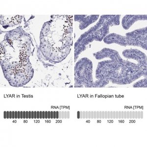 Anti-LYAR antibody produced in rabbit 