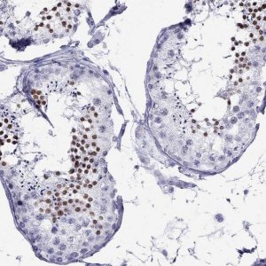 Anti-LYAR antibody produced in rabbit 