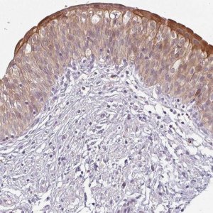 Anti-LYPLA1 antibody produced in rabbit 