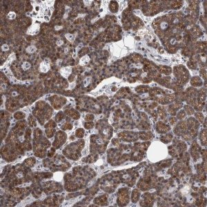 Anti-MAN2A1 antibody produced in rabbit 
