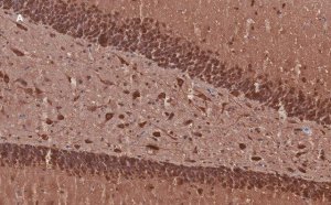 Anti-MAP2 Antibody, clone 3C19, ZooMAb� Rabbit Monoclonal 