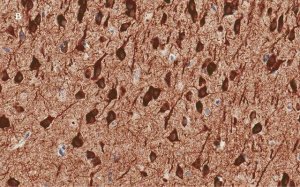 Anti-MAP2 Antibody, clone 3C19, ZooMAb� Rabbit Monoclonal 