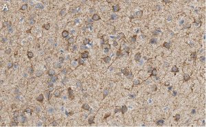 Anti-MAP2 Antibody, clone AP20 ZooMAb� Mouse Monoclonal 